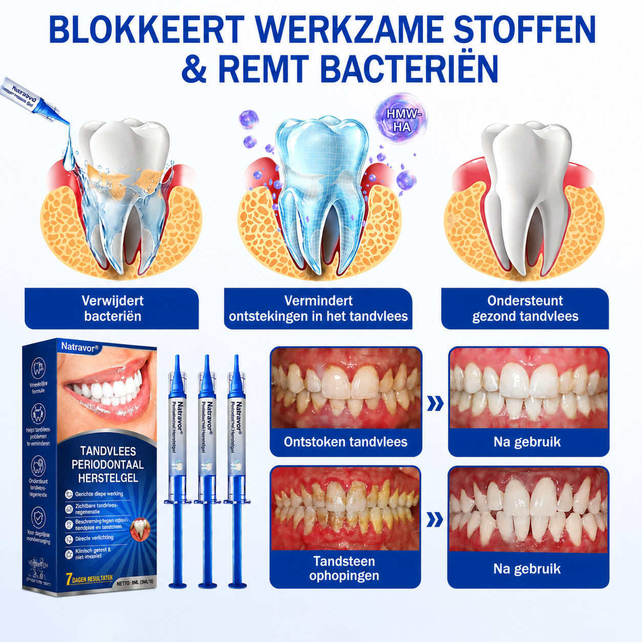 🇳🇱🏅🦷🛡️𝐍𝐚𝐭𝐫𝐚𝐯𝐨𝐫® GumRevive Tandvlees- & Parodontale Verzorgingsgel