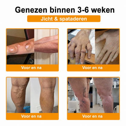 🔥 Laatste kans! Profiteer nu van deze geweldige aanbieding met 80% KORTING!  🎁 180 dagen niet-goed-geld-terug-garantie ✈️ Gratis verzending via luchtpost  Natravor®