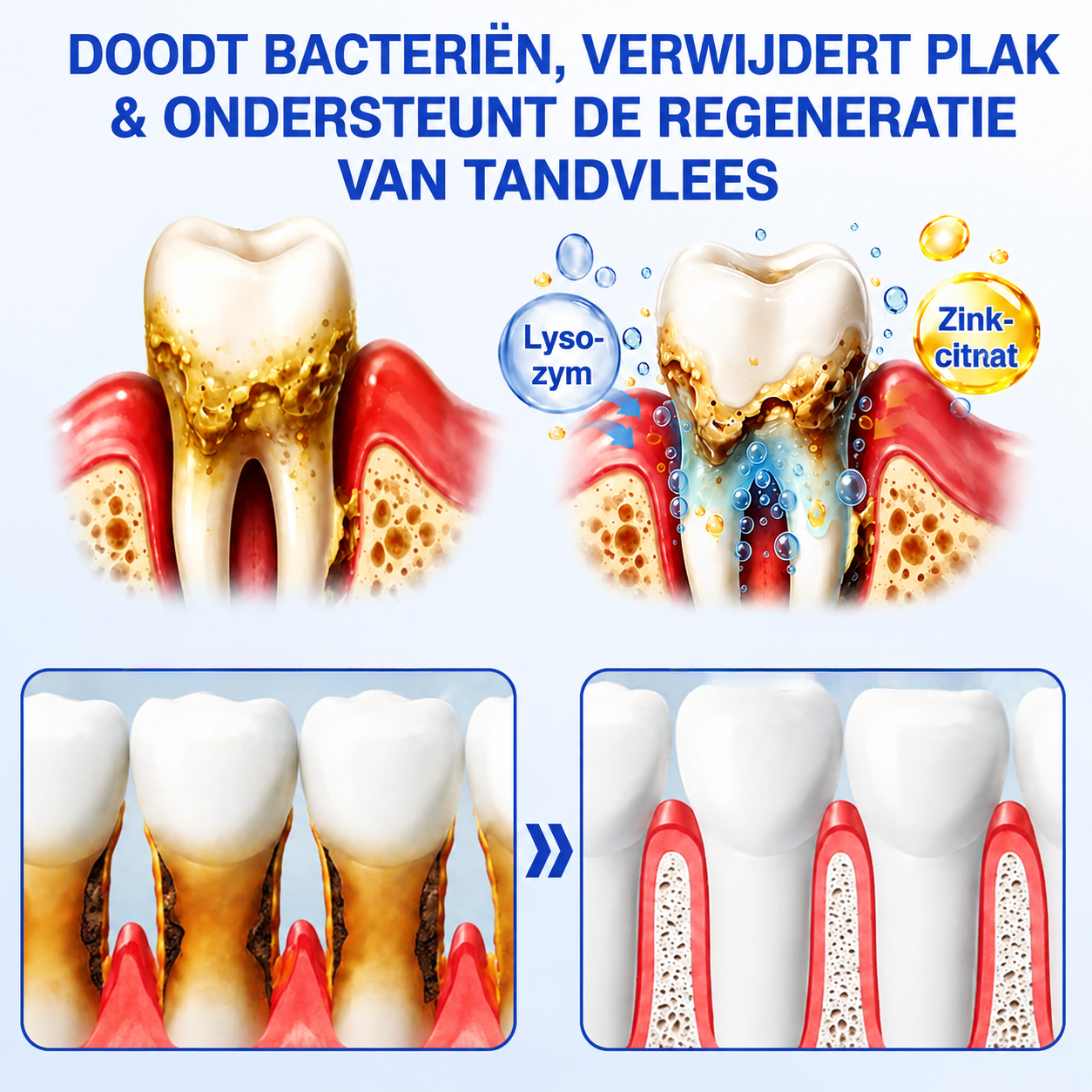 🇳🇱🏅🦷🛡️𝐍𝐚𝐭𝐫𝐚𝐯𝐨𝐫® GumRevive Tandvlees- & Parodontale Verzorgingsgel