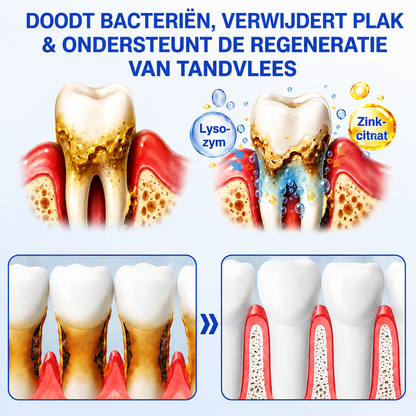 🇳🇱🏅🦷🛡️𝐍𝐚𝐭𝐫𝐚𝐯𝐨𝐫® GumRevive Tandvlees- & Parodontale Verzorgingsgel