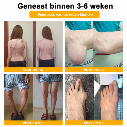 🔥 Laatste kans! Profiteer nu van deze geweldige aanbieding met 80% KORTING!  🎁 180 dagen niet-goed-geld-terug-garantie ✈️ Gratis verzending via luchtpost  Natravor®