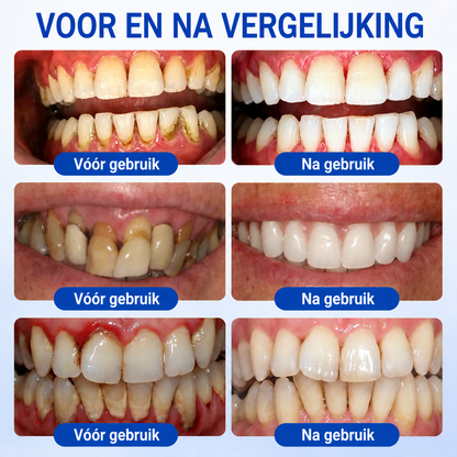 🇳🇱🏅🦷🛡️𝐍𝐚𝐭𝐫𝐚𝐯𝐨𝐫® GumRevive Tandvlees- & Parodontale Verzorgingsgel