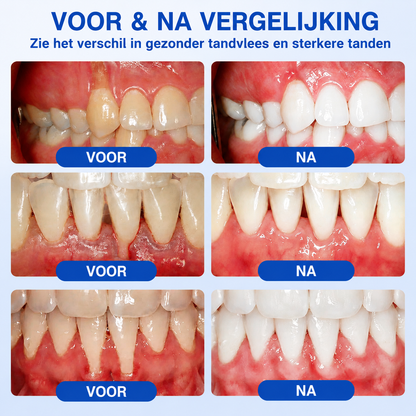 🇳🇱🏅🦷🛡️𝐍𝐚𝐭𝐫𝐚𝐯𝐨𝐫® GumRevive Tandvlees- & Parodontale Verzorgingsgel