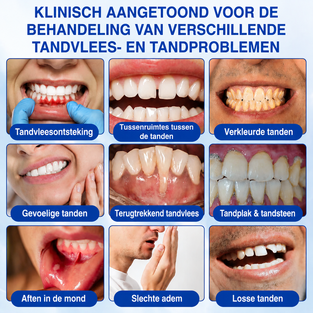 🇳🇱🏅🦷🛡️𝐍𝐚𝐭𝐫𝐚𝐯𝐨𝐫® GumRevive Tandvlees- & Parodontale Verzorgingsgel