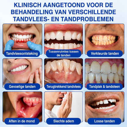 🇳🇱🏅🦷🛡️𝐍𝐚𝐭𝐫𝐚𝐯𝐨𝐫® GumRevive Tandvlees- & Parodontale Verzorgingsgel